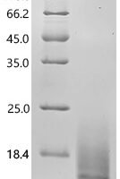 Human Gastric inhibitory polypeptide (GIP), partial Recombinant Protein - BioCrest Sci