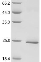 Human herpesvirus 1 Tegument protein UL11 Recombinant Protein - BioCrest Sci