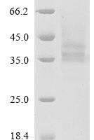 Human Protein mono-ADP-ribosyltransferase PARP14 (PARP14), partial Recombinant Protein, N-His - BioCrest Sci