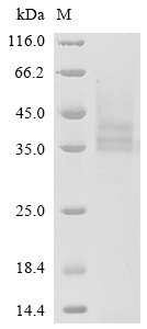 Human Protein mono-ADP-ribosyltransferase PARP14 (PARP14), partial Recombinant Protein, N-His, Homo sapiens (Human), Yeast, N-terminal 6xHis-tagged, 25.6 kDa, purity >≥ 85% as determined by SDS-PAGE.