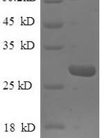 Mouse Nidogen-1 (Nid1), partial Recombinant Protein, N-His - BioCrest Sci