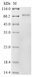 Human RNA-binding protein MEX3A (MEX3A) Recombinant Protein, Homo sapiens (Human), E.coli, N-terminal 10xHis-tagged and C-terminal Myc-tagged, 59.2 kDa, purity >≥ 85% as determined by SDS-PAGE.