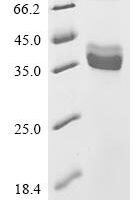 Human Proton-coupled zinc antiporter SLC30A1 (SLC30A1), partial Recombinant Protein, N-hFc1 - BioCrest Sci