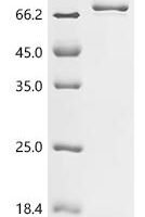 Oryza sativa subsp. japonica Jasmonoyl--L-amino acid synthetase GH3.5 (GH3.5) Recombinant Protein - BioCrest Sci