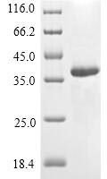 Vespula vulgaris Phospholipase A1 Recombinant Protein, C-Myc/C-His - BioCrest Sci