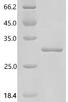 Human Lactase-phlorizin hydrolase (LCT), partial Recombinant Protein - BioCrest Sci