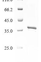 Rift valley fever virus Non-structural protein S (NSS) Recombinant Protein - BioCrest Sci