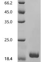 Human Membrane-spanning 4-domains subfamily A member 12 (MS4A12), partial Recombinant Protein, C-His, aa 1–90, E.coli - BioCrest Sci