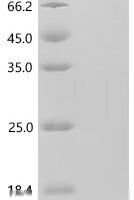 Human Growth/differentiation factor 3 (GDF3) Recombinant Protein, N-HSA/C-10His - BioCrest Sci