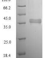 Ba (E.coli-k12) Oxidoreductase YdhF (ydhF) Recombinant Protein - BioCrest Sci