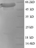 Macaca mulatta Microtubule-associated protein tau (MAPT) Recombinant Protein - BioCrest Sci
