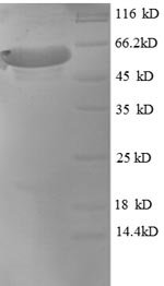 Macaca mulatta Microtubule-associated protein tau (MAPT) Recombinant Protein, Macaca mulatta (Rhesus macaque), E.coli, N-terminal 6xHis-SUMO-tagged, 63.8 kDa, purity >≥ 90% as determined by SDS-PAGE.