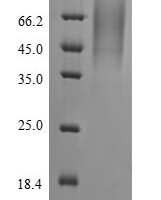 Severe acute respiratory syndrome coronavirus 2 Nucleoprotein (N) Recombinant Protein, N-His-SUMOstar - BioCrest Sci