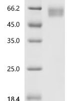 Human Interleukin-1 receptor type 1 (IL1R1), partial, Biotinylated Recombinant Protein - BioCrest Sci