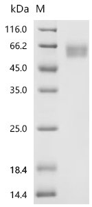 Human Interleukin-1 receptor type 1 (IL1R1), partial, Biotinylated Recombinant Protein, Homo sapiens (Human), Mammalian cell, C-terminal 10xHis-Avi-tagged, 40.8 kDa, purity >≥ 95% as determined by SDS-PAGE.≥ 95% as determined by SEC-HPLC.