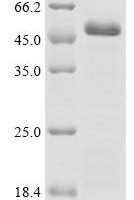Rat DNA polymerase beta (Polb) Recombinant Protein, N-His-SUMOstar - BioCrest Sci