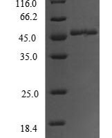 Human Forkhead box protein O3 (FOXO3), partial Recombinant Protein - BioCrest Sci