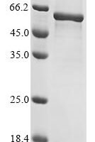 Human Spectrin alpha chain, erythrocytic 1 (SPTA1)，partial Recombinant Protein - BioCrest Sci