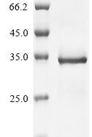 Chicken Glycine cleavage system H protein, mitochondrial (GCSH) Recombinant Protein - BioCrest Sci