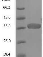 Staphylococcus aureus Acyl carrier protein (acpP) Recombinant Protein, N-GST, aa 1–77, E.coli - BioCrest Sci