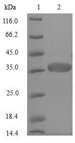 Staphylococcus aureus Acyl carrier protein (acpP) Recombinant Protein, N-GST, aa 1–77, E.coli, Staphylococcus aureus (strain Mu50 / ATCC 700699), E.coli, N-terminal GST-tagged, 35.5 kDa, purity >≥ 90% as determined by SDS-PAGE.