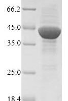 Pig Aminopeptidase N (ANPEP), partial Recombinant Protein - BioCrest Sci