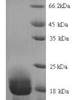Rat Allograft inflammatory factor 1 (Aif1) Recombinant Protein, N-His - BioCrest Sci