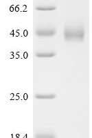 Mouse Zinc-alpha-2-glycoprotein (Azgp1) Recombinant Protein, C-10His - BioCrest Sci