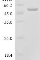 Human Glycylpeptide N-tetradecanoyltransferase 2 (NMT2), partial Recombinant Protein - BioCrest Sci