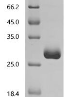 Human Chromogranin-A (CHGA), partial Recombinant Protein, C-10His, aa 224–457 - BioCrest Sci