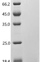 Human Guanine nucleotide-binding protein G (q) subunit alpha (GNAQ), partial Recombinant Protein, N-His - BioCrest Sci