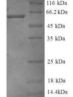 Human Guanine nucleotide-binding protein G (I)/G (S)/G (T) subunit beta-2 (GNB2), partial Recombinant Protein - BioCrest Sci