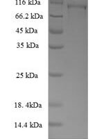 Human Methionine synthase reductase (MTRR) Recombinant Protein, N-GST - BioCrest Sci