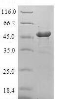Human Gamma-crystallin D (CRYGD) Recombinant Protein - BioCrest Sci