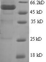 Human Polycomb complex protein BMI-1 (BMI1), partial Recombinant Protein - BioCrest Sci