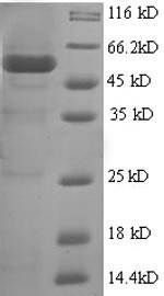 Human Polycomb complex protein BMI-1 (BMI1), partial Recombinant Protein, Homo sapiens (Human), E.coli, N-terminal GST-tagged, 56.4 kDa, purity >≥ 90% as determined by SDS-PAGE.
