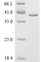 Human Tribbles homolog 3 (TRIB3) Recombinant Protein - BioCrest Sci