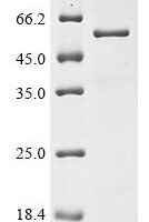Measles virus Hemagglutinin glycoprotein (H) , partial, Biotinylated Recombinant Protein - BioCrest Sci