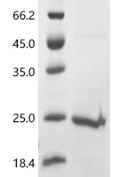 Human Protein tweety homolog 1 (TTYH1), partial Recombinant Protein - BioCrest Sci