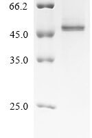 Mouse Serine protease inhibitor A3K (Serpina3k) Recombinant Protein, C-His - BioCrest Sci