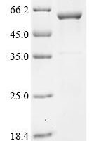 Human Cytochrome P450 2A13 (CYP2A13) Recombinant Protein - BioCrest Sci