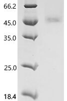 Mouse Fibroblast growth factor 8 (Fgf8) Recombinant Protein, C-10His - BioCrest Sci