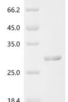 Arabidopsis thaliana Translationally-controlled tumor protein homolog (TCTP) Recombinant Protein - BioCrest Sci