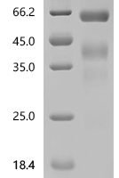 Macaca mulatta Interferon gamma (IFNG) Recombinant Protein - BioCrest Sci
