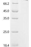 Mouse Complement factor B (Cfb) Recombinant Protein, C-His - BioCrest Sci