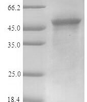 Human Alpha-enolase (ENO1) Recombinant Protein, C-His-Myc, aa 2–434, Purity ≥90% - BioCrest Sci