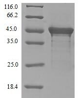 Human Eukaryotic translation initiation factor 4 gamma 1 (EIF4G1), partial Recombinant Protein, N-10His-B2M-JD/C-Myc - BioCrest Sci
