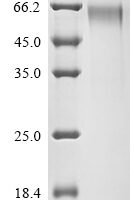 Human Syntenin-1 (SDCBP) Recombinant Protein - BioCrest Sci