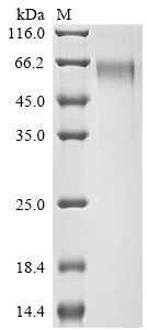 Human Syntenin-1 (SDCBP) Recombinant Protein, Homo sapiens (Human), Mammalian cell, C-terminal hFc1-Flag-tagged, 59.5 kDa, purity >≥ 90% as determined by SDS-PAGE.