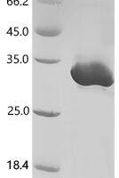 Streptococcus sp. group G Immunoglobulin G-binding protein G (spg), partial Recombinant Protein, N-His, aa 291–497, Purity ≥85%, MW 30.3 kDa - BioCrest Sci